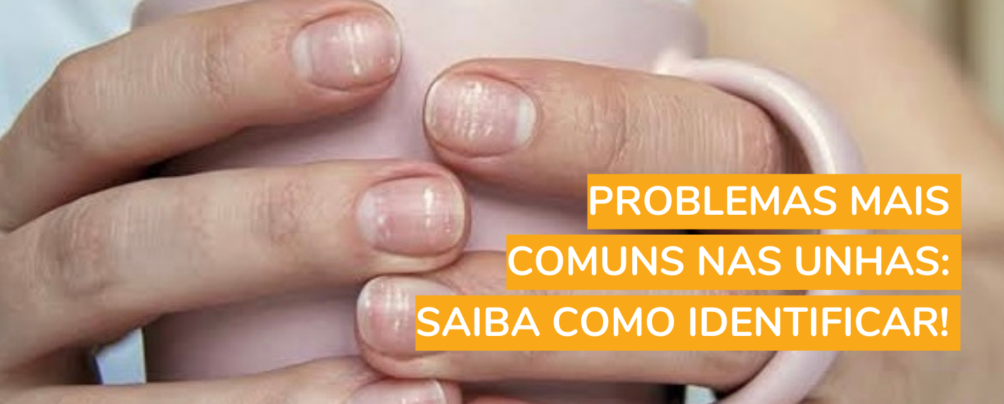 Problemas mais comuns nas unhas: saiba como identificar!